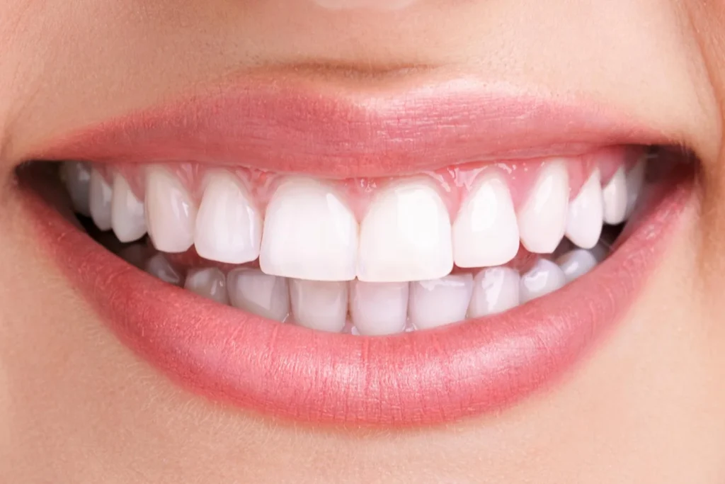 Teeth Whitening Services in USA