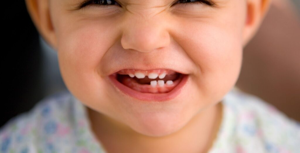 bruxism in infants