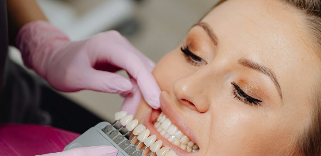 dental veneers for missing teeth