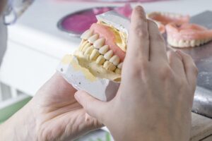 full mouth dental implants