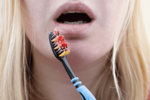 is gingivitis contagious