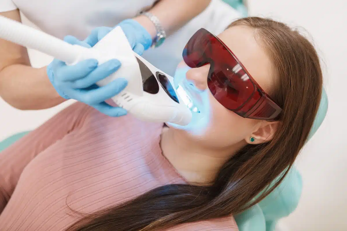 laser dental cleaning