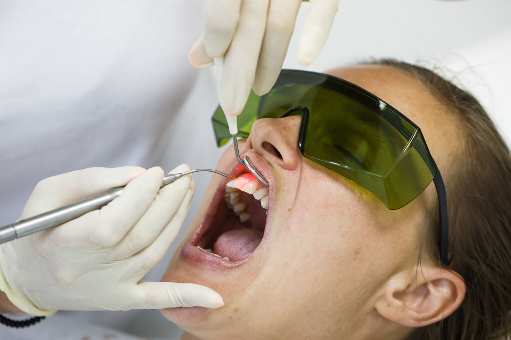 laser surgery for gums