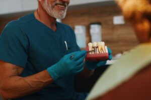 permanent dental implants