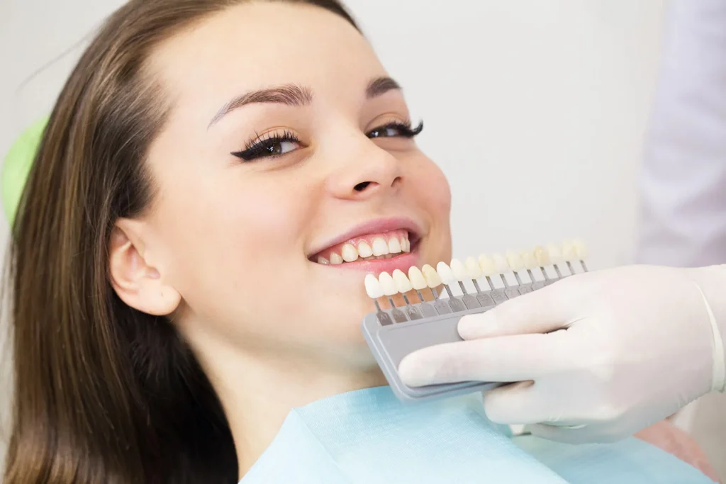 composite veneers​