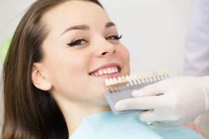 composite veneers​