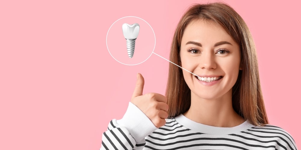 front dental implants