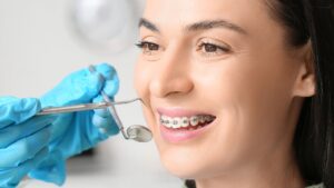 retainers for teeth