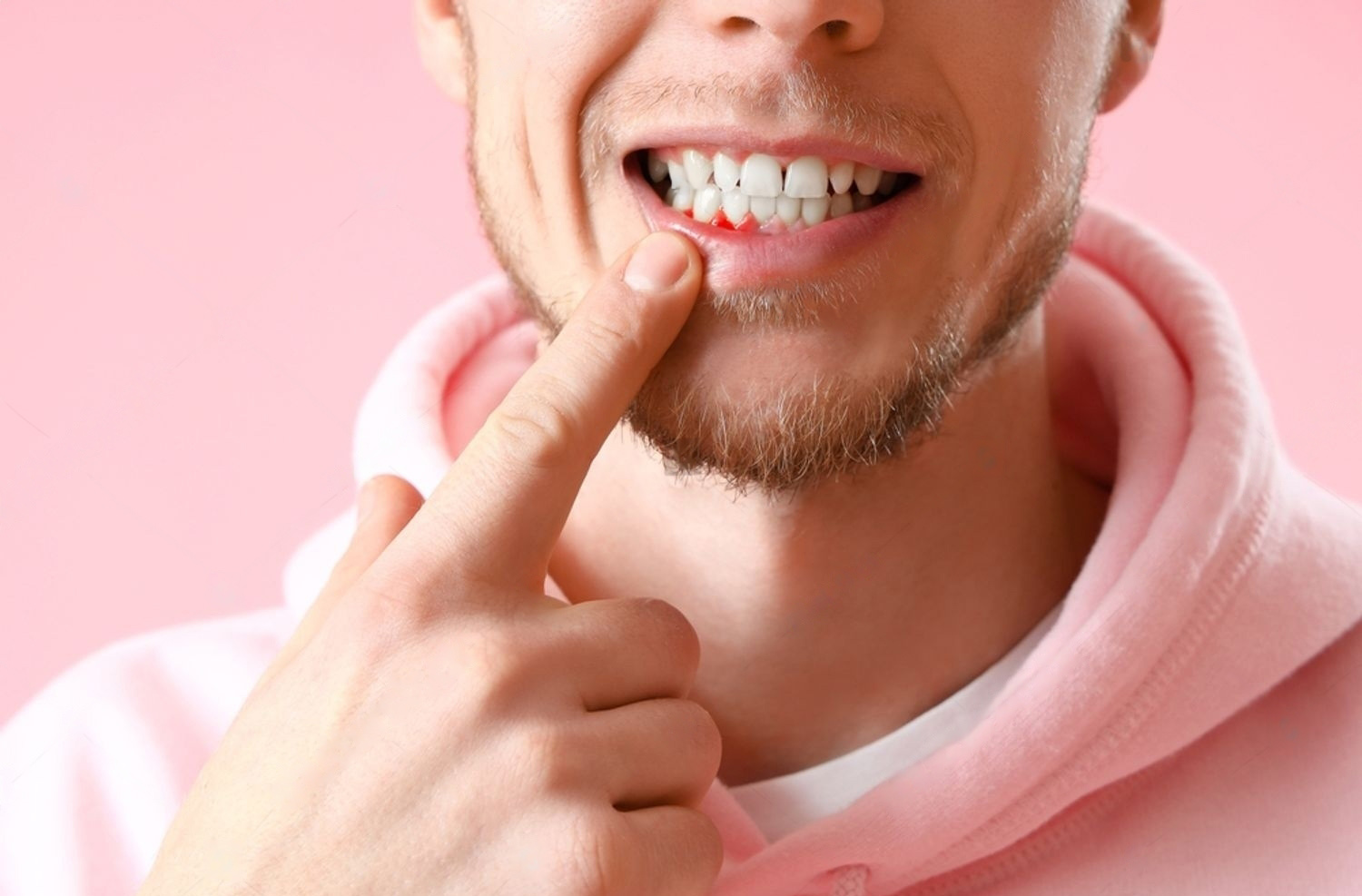 swollen gums