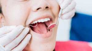 grinded teeth repair​