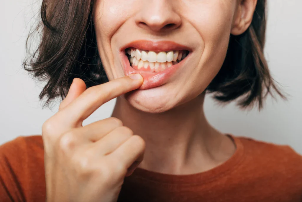 gums hurt