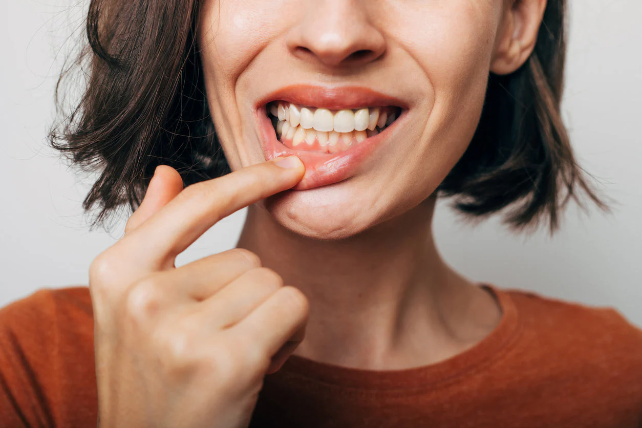 gums hurt