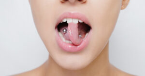infection of tongue piercing​