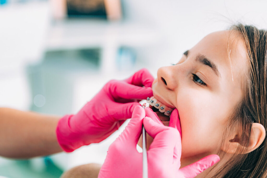 braces for kids