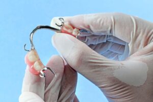 removable partial denture​