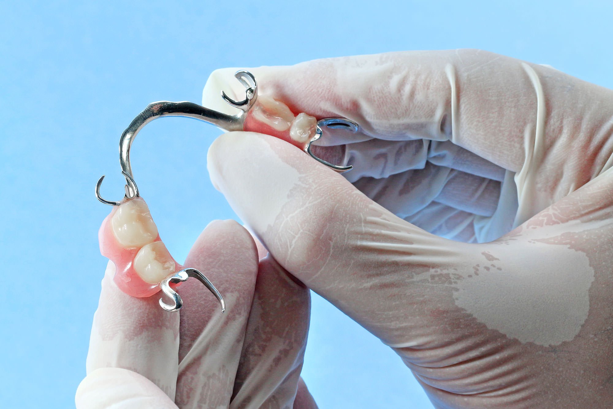removable partial denture​
