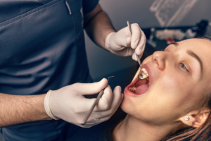 Untreated cavities in adults