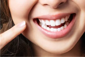 healthy gums