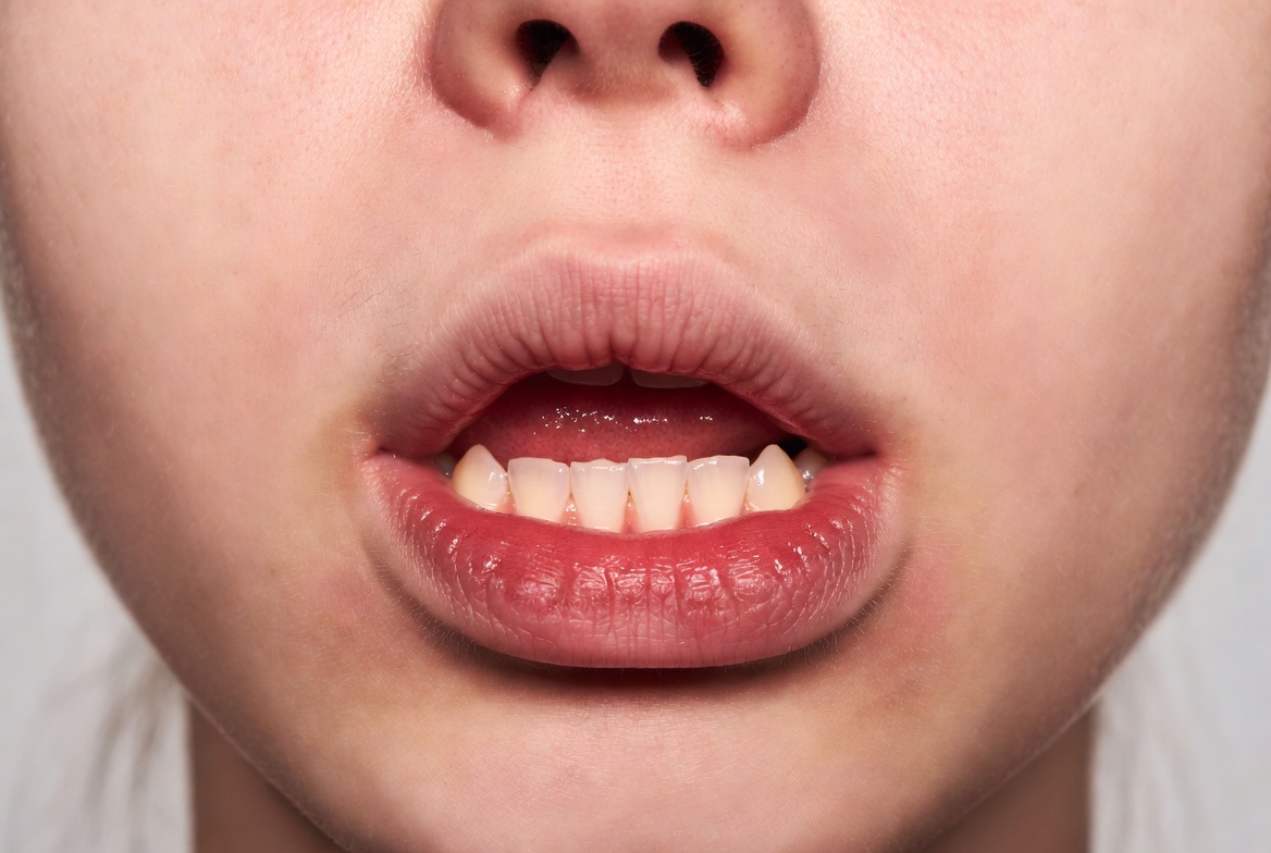 puffy gums causes