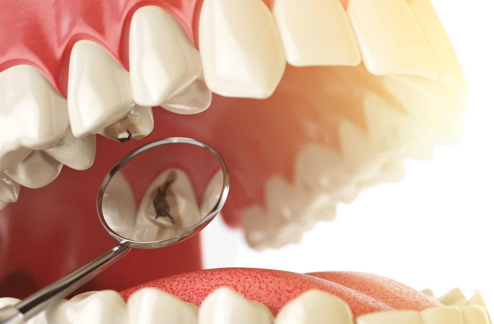 can cavities heal on their own