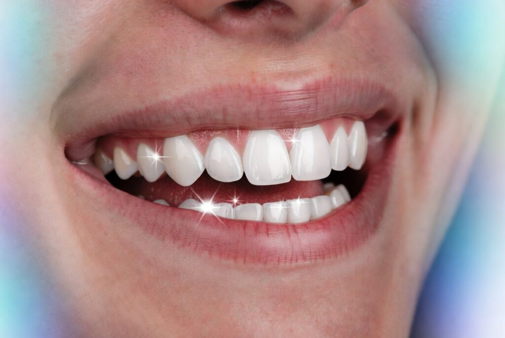 instant teeth whitening solutions
