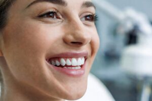smile makeover