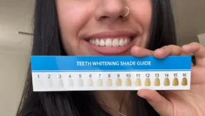 top-rated teeth whitening products